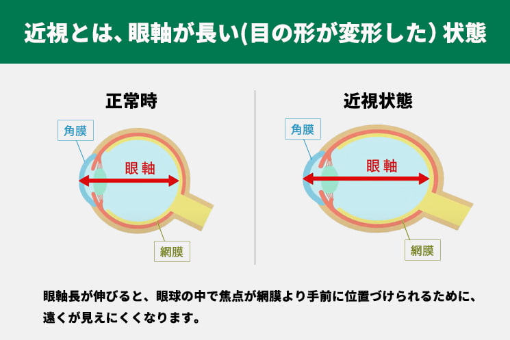 参照元：令和４年度学校保健統計（学校保健統計調査の結果）確定値